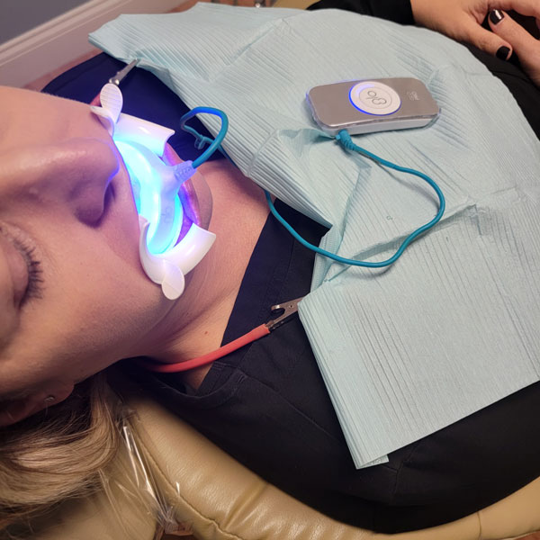 Glo System Teeth Whitening